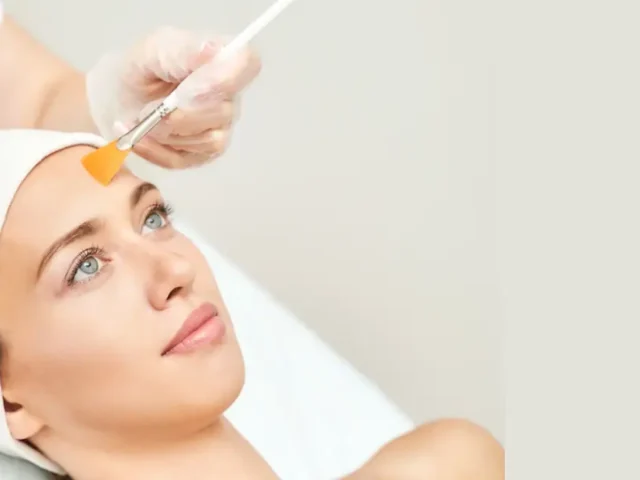 Chemical Peels Everything You Need to Know